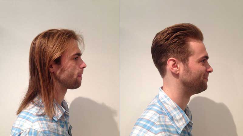 before-after