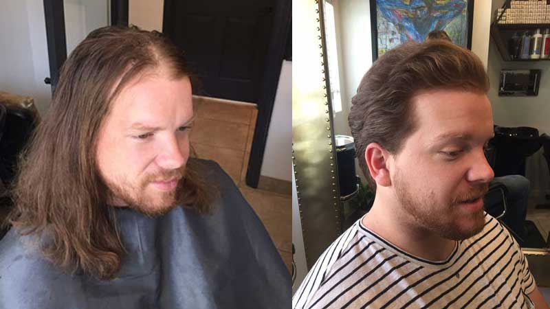 before-after